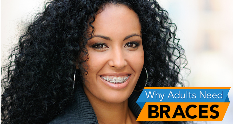 Why do adults need braces?